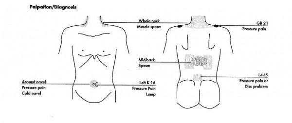 Feeling Tired But Wired? Find Out If You Have Adrenal Exhaustion With This Simple Technique adrenal diagram