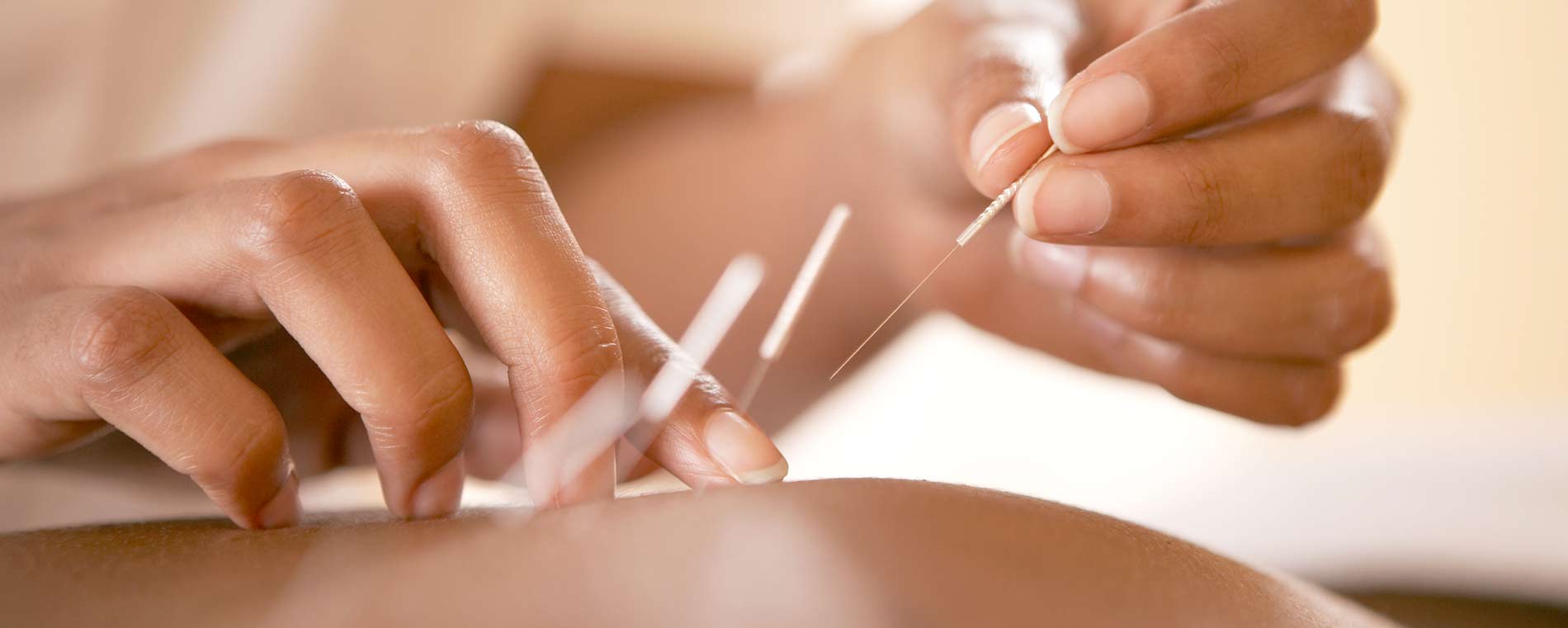 Injury Management and Chinese Medicine